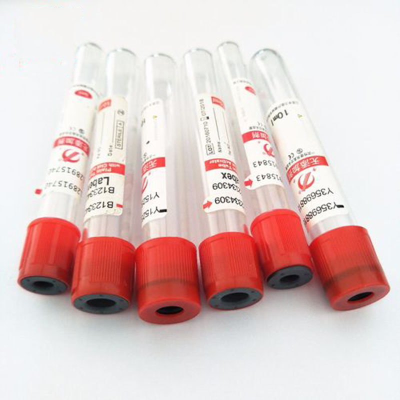 100 개/몫 3ml 5ml 10ml 일회용 유리 진공 - Blood Collection Tube 리뷰 및 가격