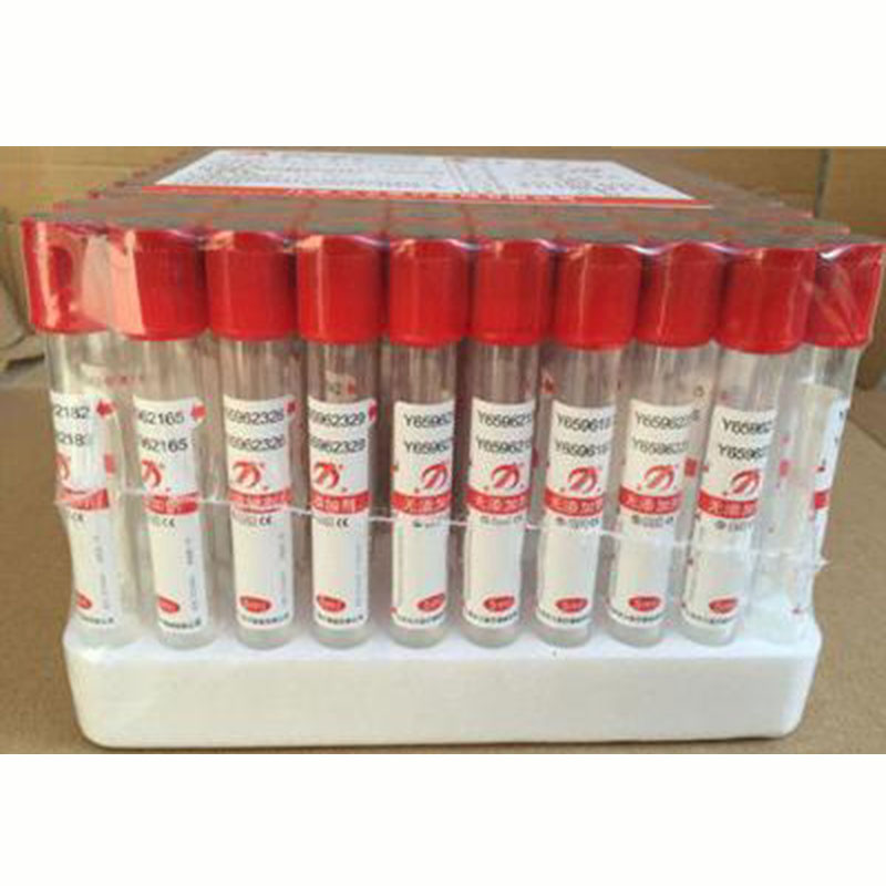 100 개/몫 3ml 5ml 10ml 일회용 유리 진공 - Blood Collection Tube 리뷰 및 가격